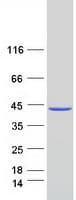 Human MAT2B Protein (Recombinant Myc-DDK (Flag))