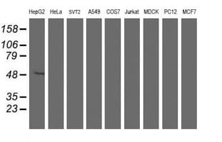 ALG2 Antibody (clone OTI3C2, Carrier-free)