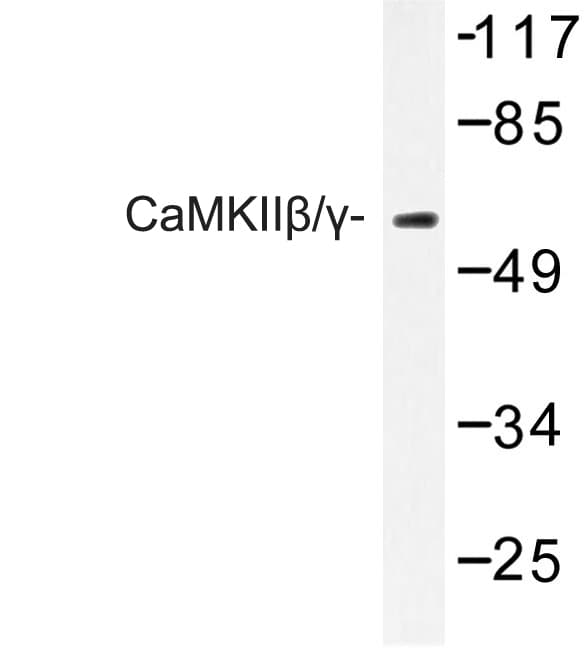 CaMKII Beta+Gamma Antibody (Arg631)