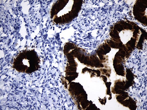 Monoclonal Mouse anti-Human NR5A1 / SF1 Antibody (clone OTI10E2, aa1-262, IHC)