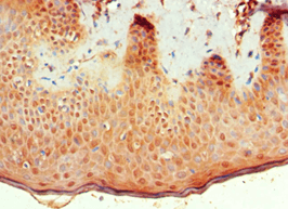 Polyclonal Rabbit anti-Human BMP15 Antibody (aa143-392, IHC)