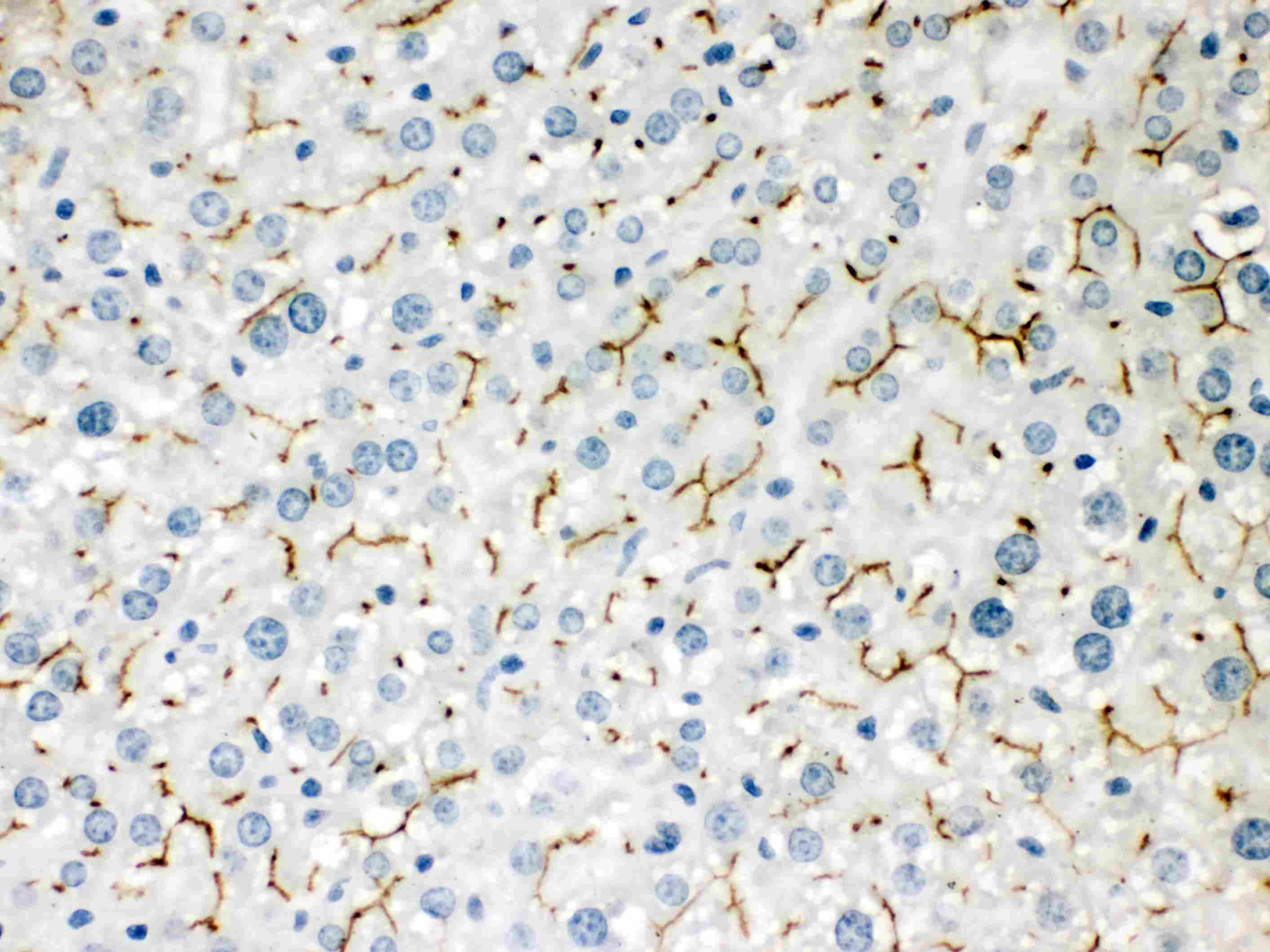 ABCB11 / BSEP Antibody