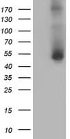 GOLM1 / GP73 / GOLPH2 Antibody (clone OTI7B3)