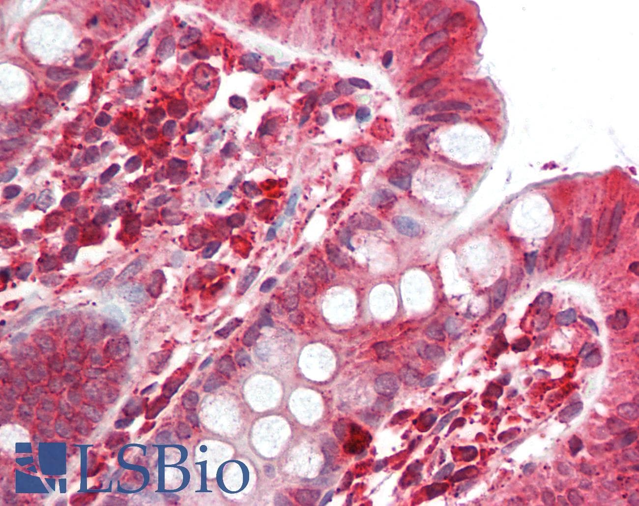 IHC-plus™ SGSM2 Antibody
