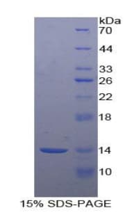 Human F7 / Factor VII Protein (Recombinant His)