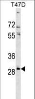 Polyclonal Rabbit anti-Human RNF138 Antibody (aa76-103, WB)