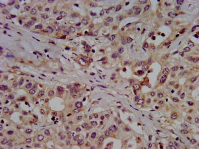 SLC7A1 / CAT1 Antibody