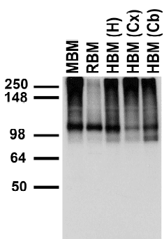 Monoclonal Mouse anti-Human TRPC7 Antibody (clone S64A-36, aa845-862, IHC, IF, WB)
