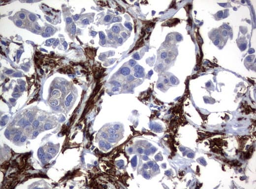 FCGR1A / CD64 Antibody (clone UMAB74, Carrier-free)
