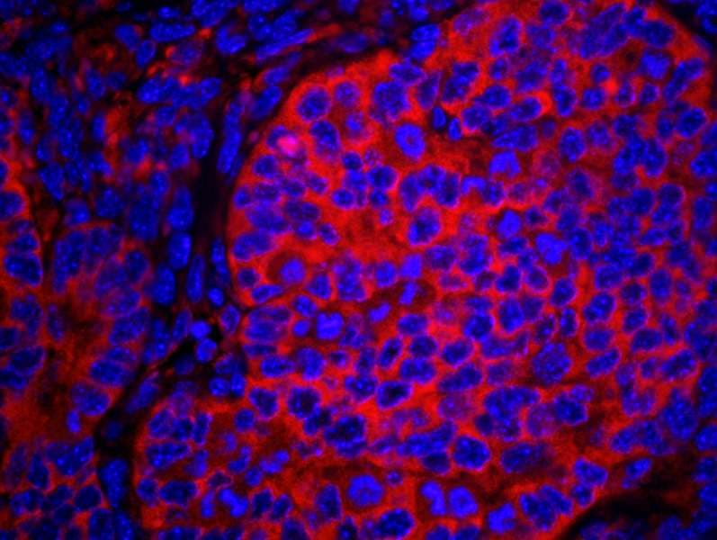 EIF2S1 Antibody (aa275-C-term)