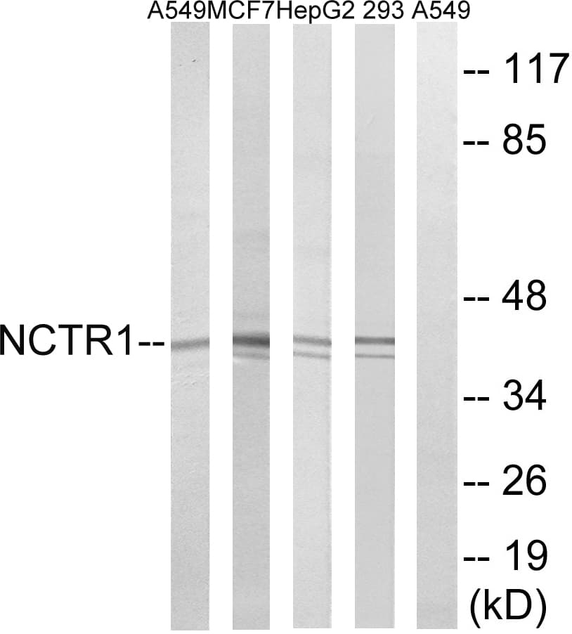 NCR1 / NKP46 Antibody (aa145-194)