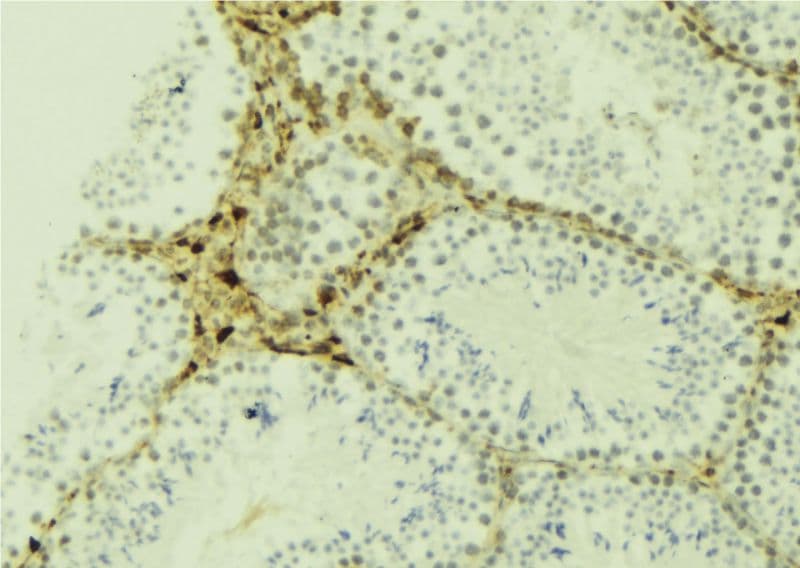 JAKMIP2 Antibody