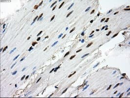 RPA2 / RFA2 / RPA34 Antibody (clone OTI8B3)