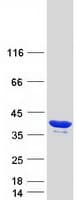 Human CCDC101 Protein (Recombinant Myc-DDK (Flag))