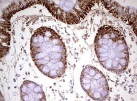 HADH Antibody (aa57-314, clone OTI3D12)