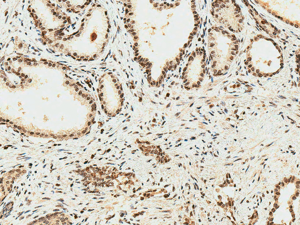 HMOX2 / Heme Oxygenase 2 Antibody (PerCP)