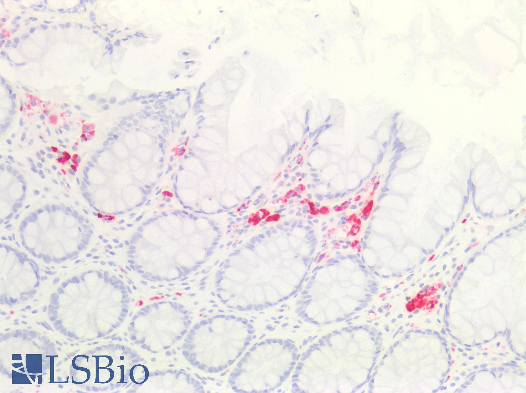 PathPlus™ ACP5 / TRAP Antibody (aa221-325, clone 5C5E7)