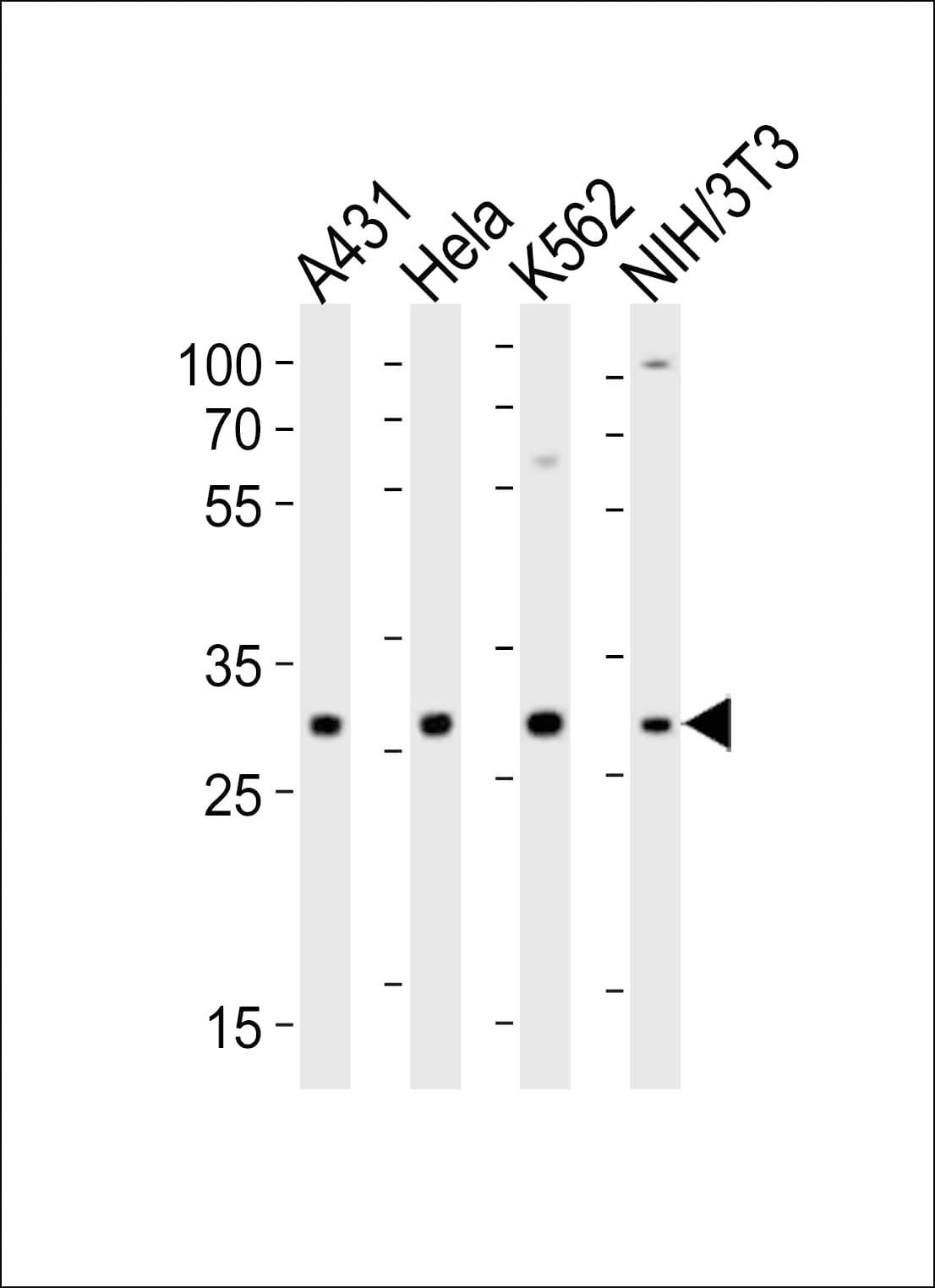 Polyclonal Rabbit anti-Human CDK5 Antibody (aa254-289, WB)