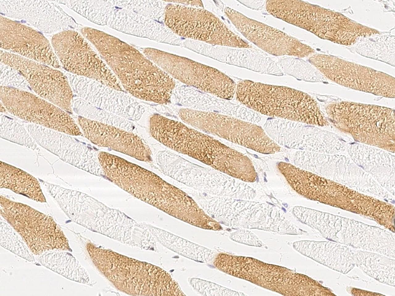 Polyclonal Rabbit anti-Human MAP2K4 / MKK4 Antibody (Preservative Free, IHC, IF)