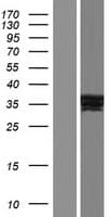 NR1I3 / CAR Protein (Over-Expression Lysate Myc-DDK (Flag))