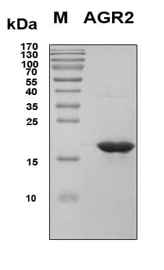 Human AGR2 Protein (Recombinant 6His, N-terminus)