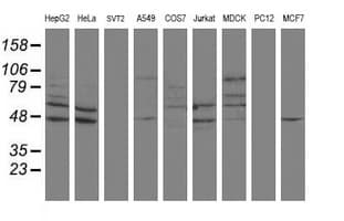 Monoclonal Mouse anti-Human SENP2 Antibody (clone OTI1D7, IHC, IF, WB)