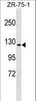 ERN1 / IRE1 Antibody (aa828-857)