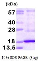 Human DUSP19 / SKRP1 Protein (Recombinant His)