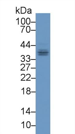 FGL1 / Hepassocin Antibody (aa23-314)
