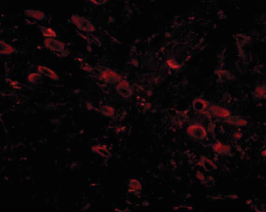 IHC-plus™ GLE1 Antibody