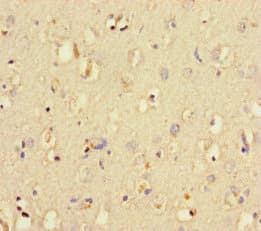 Polyclonal Rabbit anti-Human LIG3 / DNA Ligase III Antibody (IHC, IF)