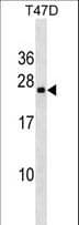 Polyclonal Rabbit anti-Human VCX3A Antibody (aa1-30, WB)