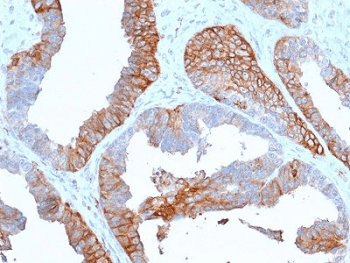 Monoclonal Mouse anti-Human HLA-DRA Antibody (clone TAL 1B5, Azide-free,BSA-free, IHC)