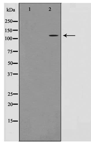 Polyclonal Rabbit anti-Human RBM26 / SE70 Antibody (WB)