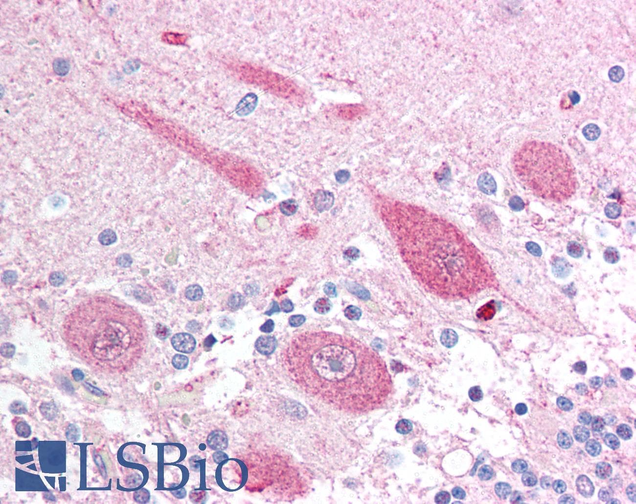 IHC-plus™ Polyclonal Rabbit anti-Human APH1A / APH-1 Antibody (IHC, WB)