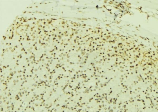 USP7 / HAUSP Antibody