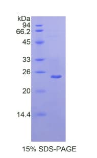 Human MMP13 Protein (Recombinant His)