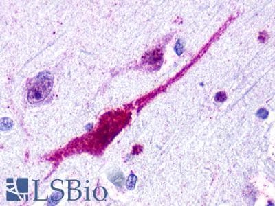 PathPlus™ GPR62 Antibody (C-Terminus)