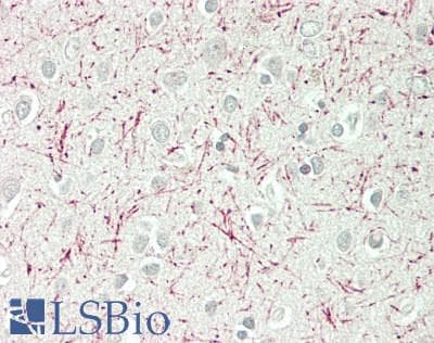 IHC-plus™ SCNN1D Antibody (aa397-446)