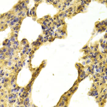 Polyclonal Rabbit anti-Human NDRG2 Antibody (IHC, WB)