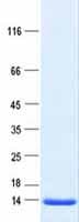 Human CCL8 / MCP2 Protein (Recombinant DDK,C-terminus)