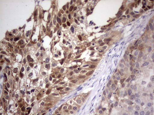 PAFAH1B3 Antibody (clone OTI4A9)