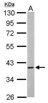 CAMK1D Antibody (aa1-385)