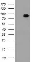 Monoclonal Mouse anti-Human MAPK7 / ERK5 Antibody (clone OTI1A4, IF, WB)