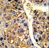 EFTU / TUFM Antibody (aa75-104)