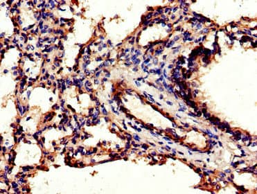 C/EBP Beta / CEBPB Antibody