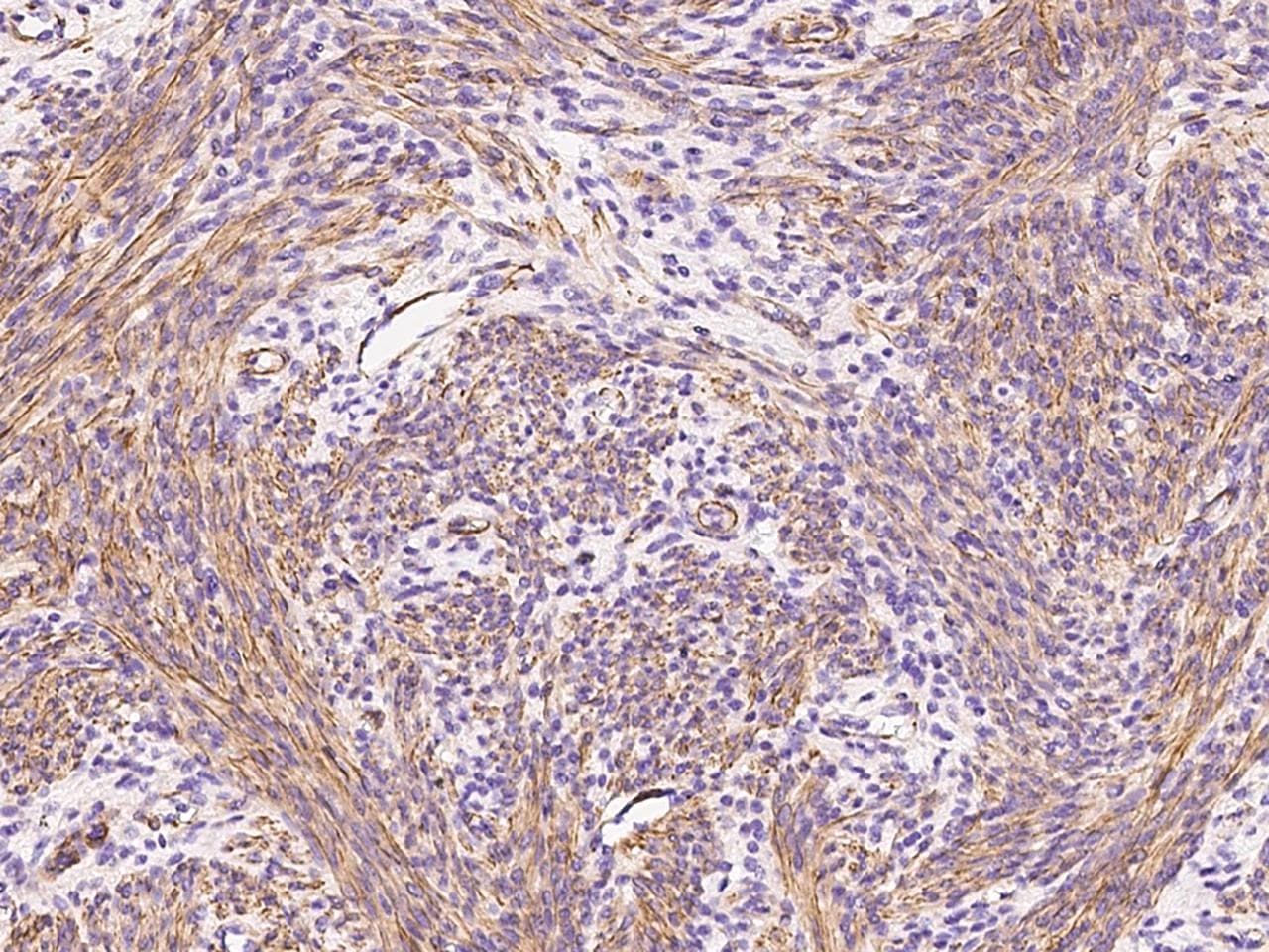CALD1 / Caldesmon Antibody (Preservative Free)