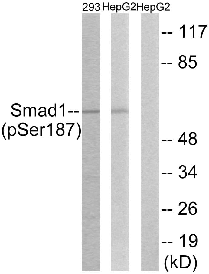 Polyclonal Rabbit anti-Human SMAD1 Antibody (phospho-Ser187, IHC, WB)
