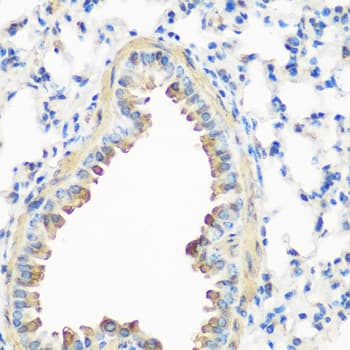 CAV3 / Caveolin 3 Antibody