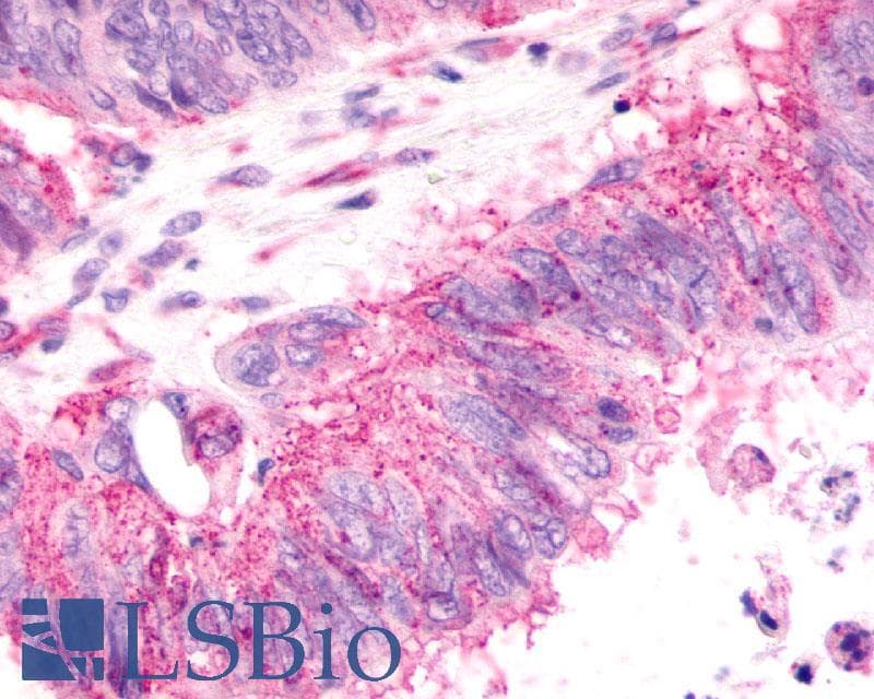 IHC-plus™ CXCR2 Antibody (N-Terminus)